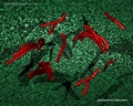 mycobacterium tuberculosis, bastoncini acidi