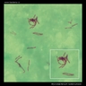 mycobacterium tuberculosis coloration Z-N