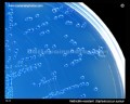 Methicillin-resistant Staphylococcus aureus (MRSA)