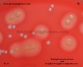 coagulase positive and negative staphylococcus