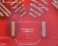 hyaluronidase production by staphylococcus aureus 