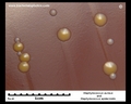 s.aureus colonies on chocolate agar