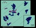 Staphylococcus aureus colony morphology and microscopic appearance ...