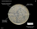 staphylococcus aureus on Baird Parker agar