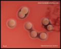 colony of staphylococcus aureus