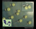 staphylococcus aureus yellow colonies