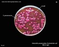 klebsiella pneumoniae and e.coli on Endo