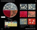 klebsiella pneumoniae colony morphology on agar media