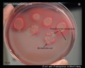 pseudomonas aeruginosa and e.coli
