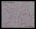 pseudomonas aeruginosa Gram stain micrograph