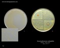stenotrophomonas maltophilia