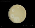 stenotrophomonas maltophilia