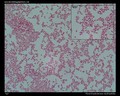 stenotrophomonas maltophilia