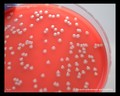 stenotrophomonas maltophilia