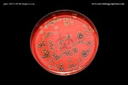 plate-2013-3-15-10-streptococcus