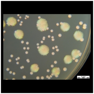 Enterococcus faecalis, Pseudomonas aeruginosa, TSA agar
