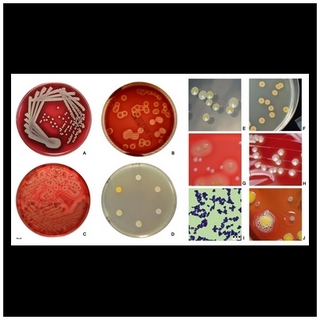 staphylococcus aureus colony morphology