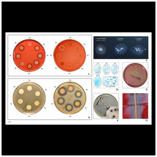 staphylococcus aureus identification tests