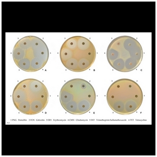 staph aureus susceptibility to various antibiotics